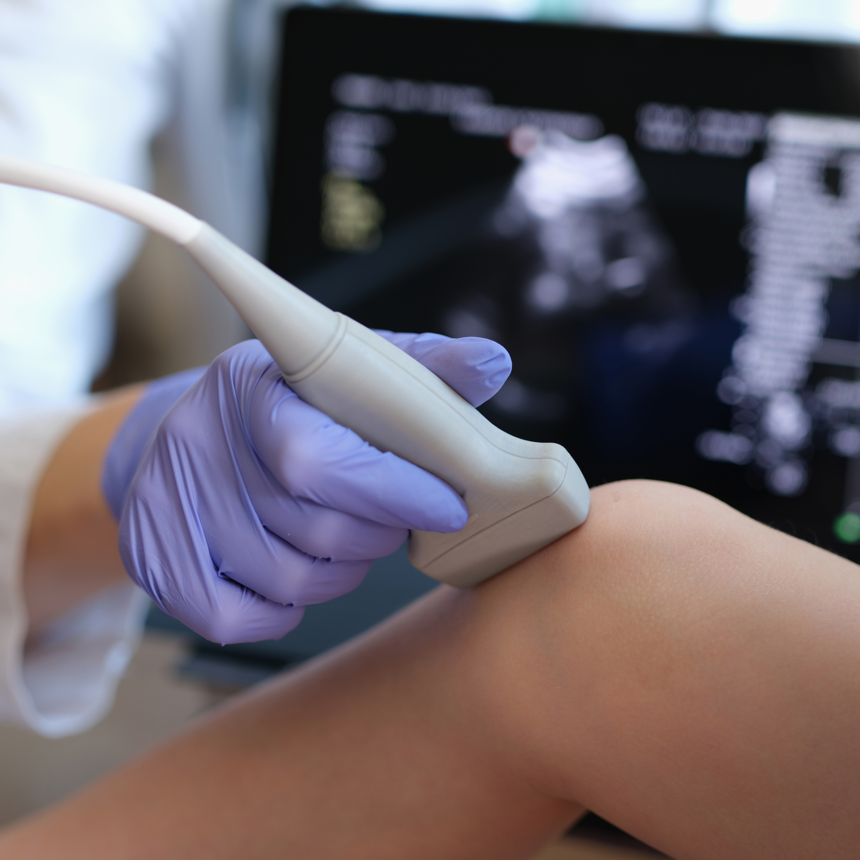Juvenile Idiopathic Arthritis